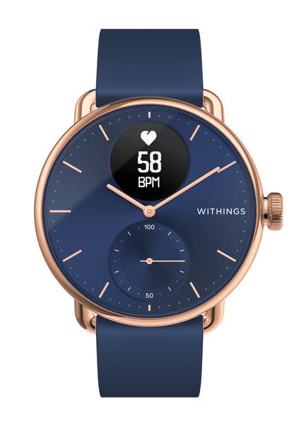 ScanWatch