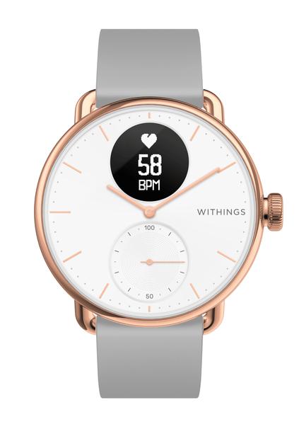 ScanWatch