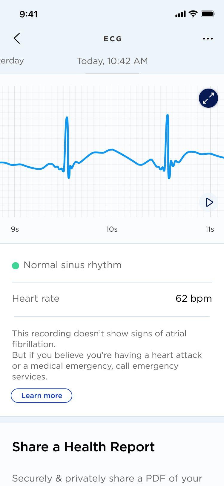 Health Mate App | Withings