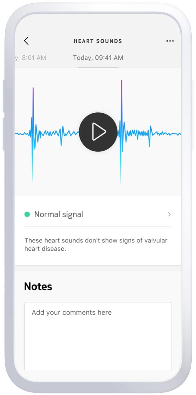 BPM Core | Withings